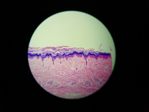 Stratified Squamous Epithelium Slides - Stratified Squamous Epithelium 02 100X
